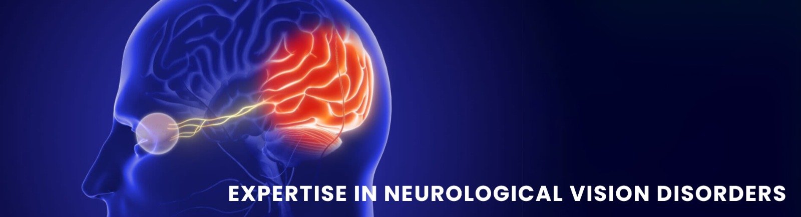 Neuro Ophthalmology Services